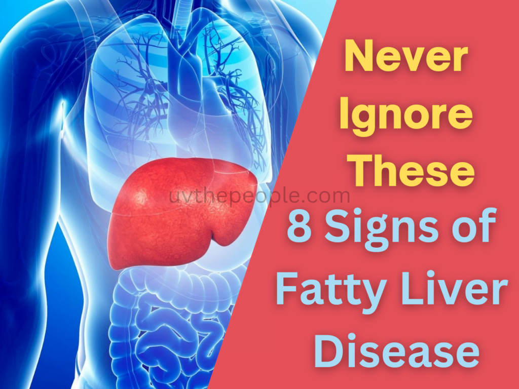 Fatty liver disease
