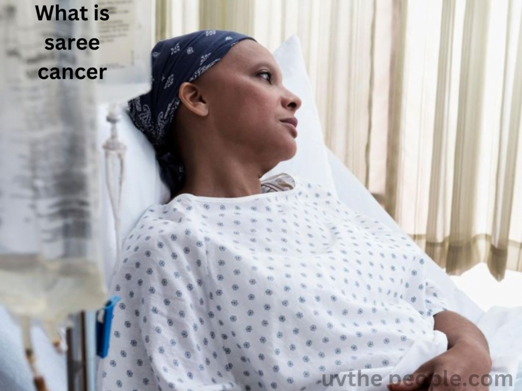 What is saree cancer